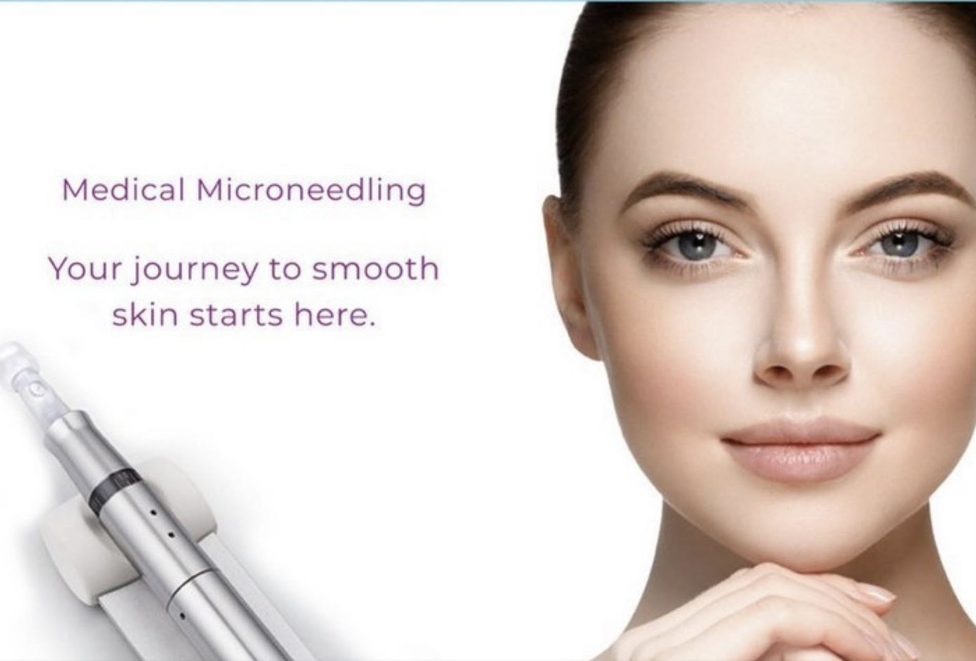 microneedling